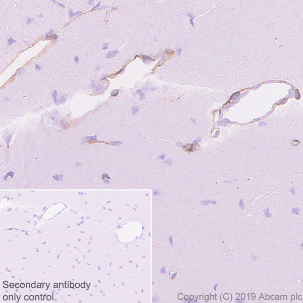 Immunohistochemistry (Formalin/PFA-fixed paraffin-embedded sections) - Anti-Laminin gamma 3 antibody [EPR22699-151] - BSA and Azide free (AB267391), expandable thumbnail