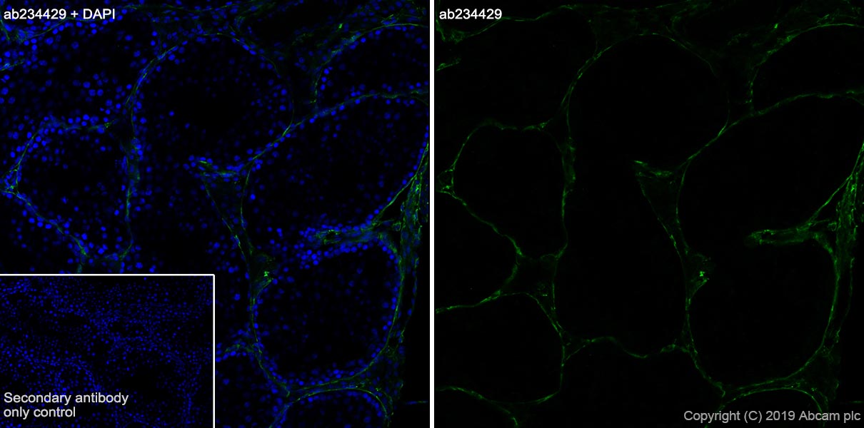 Immunohistochemistry (Frozen sections) - Anti-Laminin gamma 3 antibody [EPR22699-151] - BSA and Azide free (AB267391), expandable thumbnail