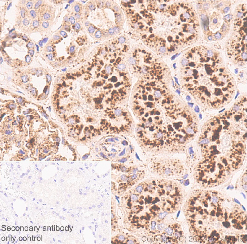 Immunohistochemistry (Formalin/PFA-fixed paraffin-embedded sections) - Anti-LAMP1 antibody [1483CT517.45.23] - Lysosome Marker (AB302639), expandable thumbnail