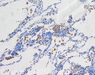 Immunohistochemistry (Formalin/PFA-fixed paraffin-embedded sections) - Anti-LAMP1 antibody [1D4B] (AB25245), expandable thumbnail