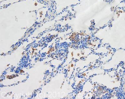 Immunohistochemistry (Formalin/PFA-fixed paraffin-embedded sections) - Anti-LAMP1 antibody [1D4B] - Lysosome Marker (AB25245)
