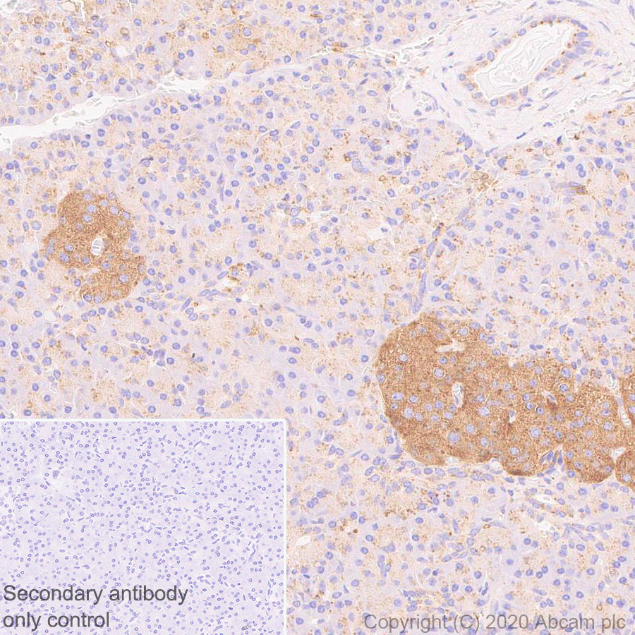 Immunohistochemistry (Formalin/PFA-fixed paraffin-embedded sections) - Anti-LAMP1 antibody [EPR24395-31] (ab278043), expandable thumbnail