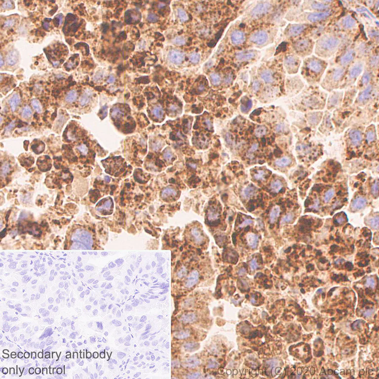 Immunohistochemistry (Formalin/PFA-fixed paraffin-embedded sections) - Anti-LAMP1 antibody [EPR24395-31] - Lysosome Marker (AB278043)