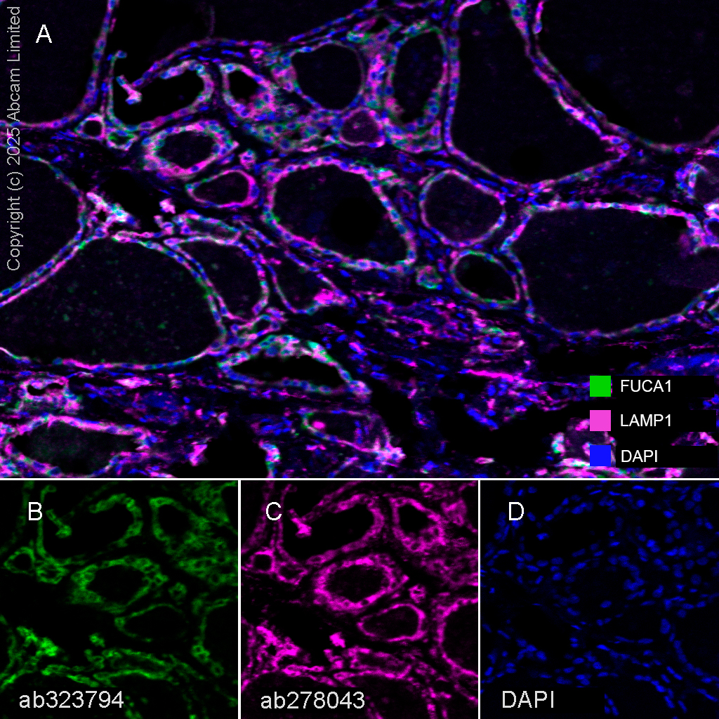 Multiplex immunohistochemistry - Anti-LAMP1 antibody [EPR24395-31] (ab278043), expandable thumbnail