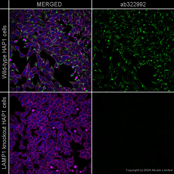 Immunocytochemistry/ Immunofluorescence - Anti-LAMP1 antibody [EPR24395-31] - Mouse IgG1 (Chimeric) (AB322992)