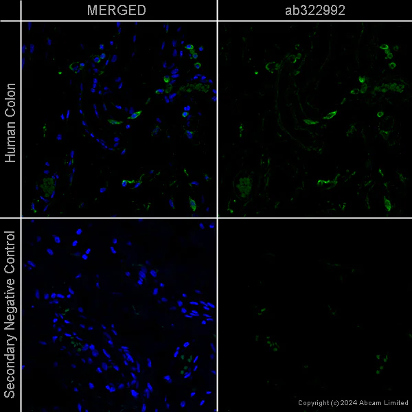 Immunohistochemistry (Formalin/PFA-fixed paraffin-embedded sections) - Anti-LAMP1 antibody [EPR24395-31] - Mouse IgG1 (Chimeric) - BSA and Azide free (AB322998)
