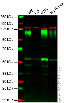 Western blot - Anti-LAMP1 antibody [EPR4204] - BSA and Azide free (AB247693)