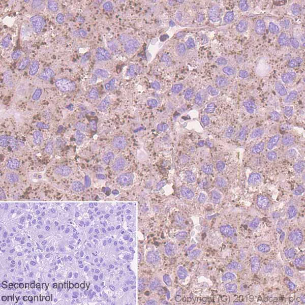 Immunohistochemistry (Formalin/PFA-fixed paraffin-embedded sections) - Anti-LAMP1 antibody [EPR4204] - Lysosome Marker (AB108597)