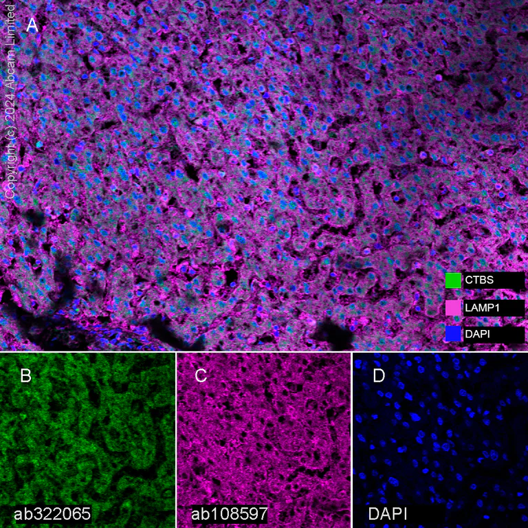 Multiplex immunohistochemistry - Anti-LAMP1 antibody [EPR4204] - Lysosome Marker (AB108597)