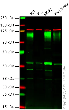 Western blot - Anti-LAMP1 antibody [EPR4204] - Lysosome Marker (AB108597)