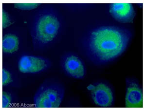Immunocytochemistry/ Immunofluorescence - Anti-LAMP1 antibody [H4A3] (ab25630), expandable thumbnail