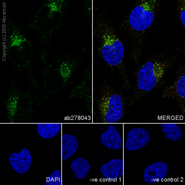 Immunocytochemistry/ Immunofluorescence - Anti-LAMP1 antibody [H4A3] (AB25630), expandable thumbnail