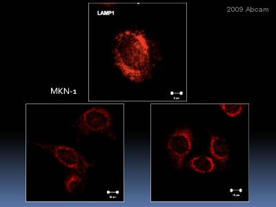 Immunocytochemistry/ Immunofluorescence - Anti-LAMP1 antibody [H4A3] (ab25630), expandable thumbnail
