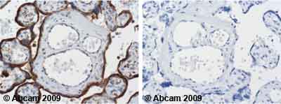Immunohistochemistry (Formalin/PFA-fixed paraffin-embedded sections) - Anti-LAMP1 antibody [H4A3] (ab25630), expandable thumbnail