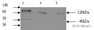 Western blot - Anti-LAMP1 antibody [H4A3] (ab25630), expandable thumbnail