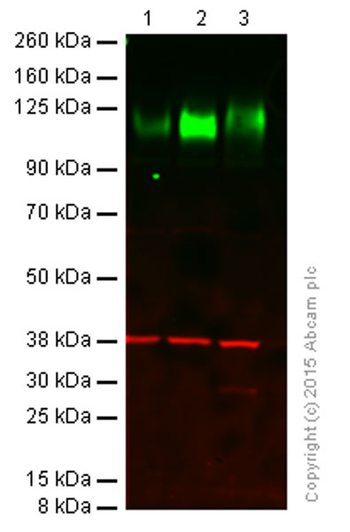 Western blot - Anti-LAMP1 antibody [H4A3] (AB25630), expandable thumbnail