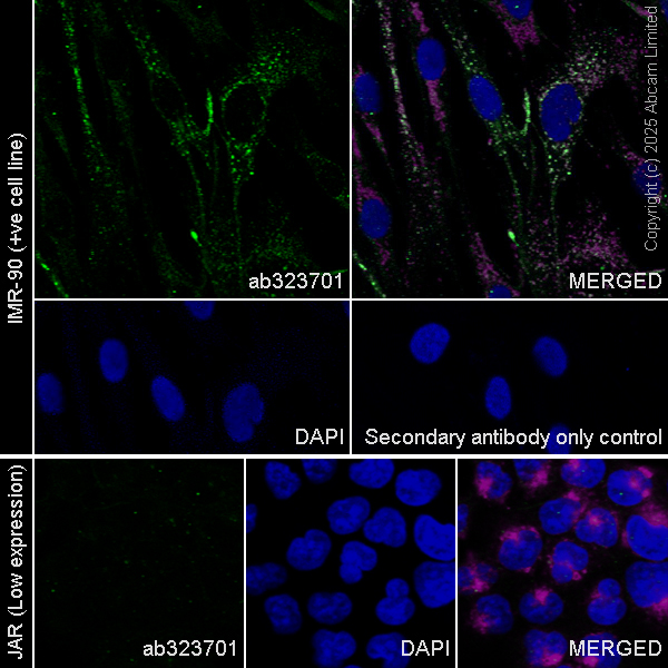 Immunocytochemistry/ Immunofluorescence - Anti-LAMP1 antibody [H4A3] (ab25630), expandable thumbnail