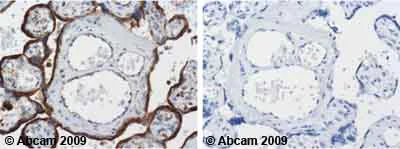 Immunohistochemistry (Formalin/PFA-fixed paraffin-embedded sections) - Anti-LAMP1 antibody [H4A3] - Lysosome Marker (AB25630)