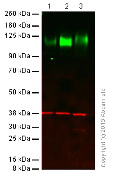 Western blot - Anti-LAMP1 antibody [H4A3] - Lysosome Marker (AB25630)