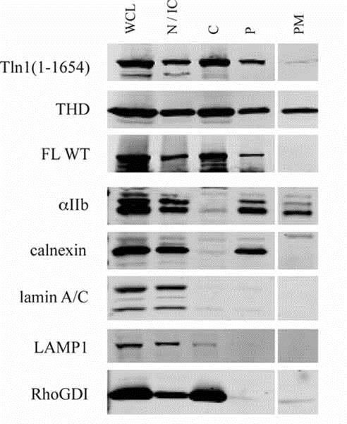 Western blot - Anti-LAMP1 antibody [LY1C6] (AB13523), expandable thumbnail