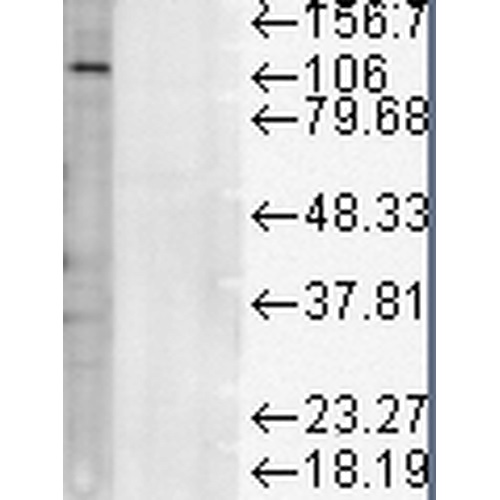 Western blot - Anti-LAMP1 antibody [LY1C6] (AB13523), expandable thumbnail