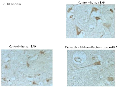 Immunohistochemistry (Formalin/PFA-fixed paraffin-embedded sections) - Anti-LAMP1 antibody - Lysosome Marker (AB24170)