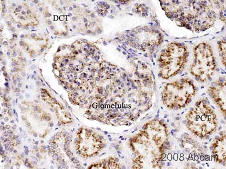 Immunohistochemistry (Formalin/PFA-fixed paraffin-embedded sections) - Anti-LAMP1 antibody - Lysosome Marker (AB24170)
