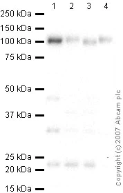 Western blot - Anti-LAMP1 antibody - Lysosome Marker (AB24170)