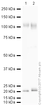 Western blot - Anti-LAMP1 antibody - Lysosome Marker (AB24170)