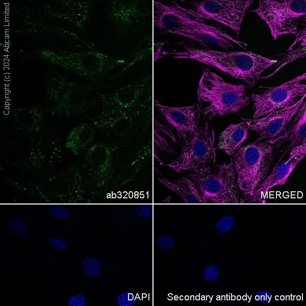 Immunocytochemistry/ Immunofluorescence - Anti-LAMP1 antibody [RM1217] - BSA and Azide free (AB320852)
