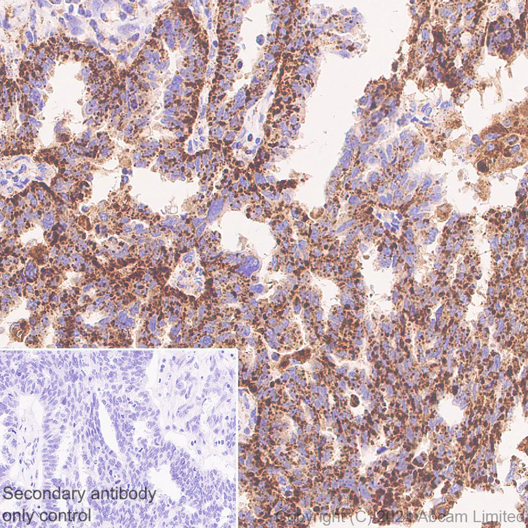 Immunohistochemistry (Formalin/PFA-fixed paraffin-embedded sections) - Anti-LAMP1 antibody [RM1217] - BSA and Azide free (AB320852)