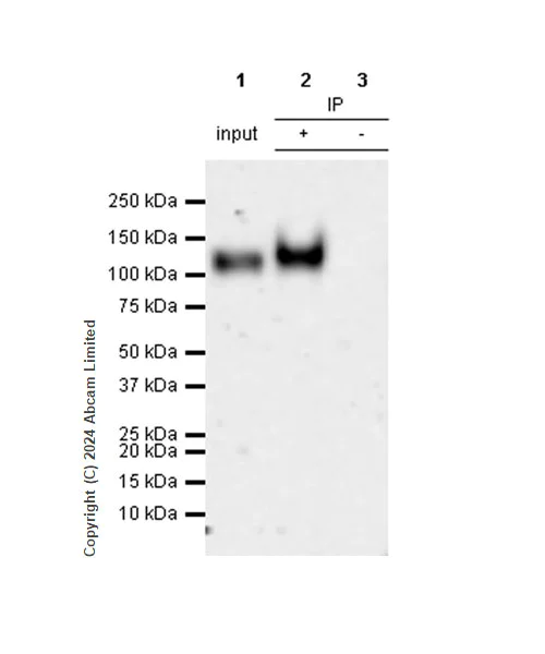 Immunoprecipitation - Anti-LAMP1 antibody [RM1217] - BSA and Azide free (AB320852)