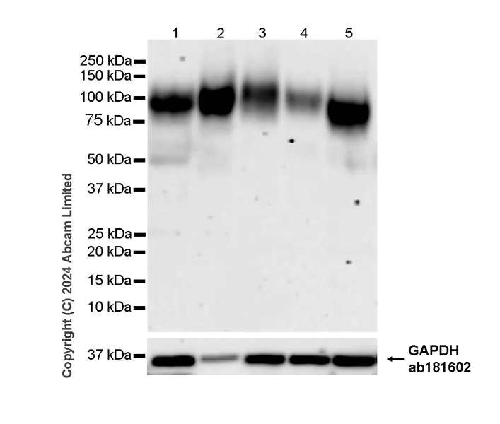 Western blot - Anti-LAMP1 antibody [RM1217] - BSA and Azide free (AB320852)
