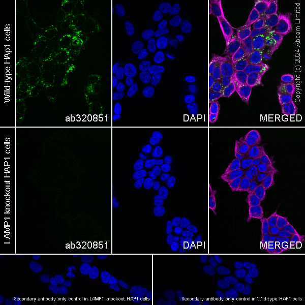 Immunocytochemistry/ Immunofluorescence - Anti-LAMP1 antibody [RM1217] (ab320851), expandable thumbnail