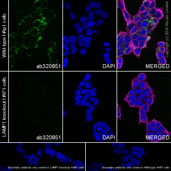 Immunocytochemistry/ Immunofluorescence - Anti-LAMP1 antibody [RM1217] - Lysosome Marker (AB320851)