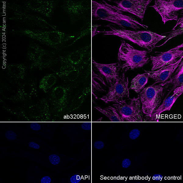 Immunocytochemistry/ Immunofluorescence - Anti-LAMP1 antibody [RM1217] (ab320851), expandable thumbnail
