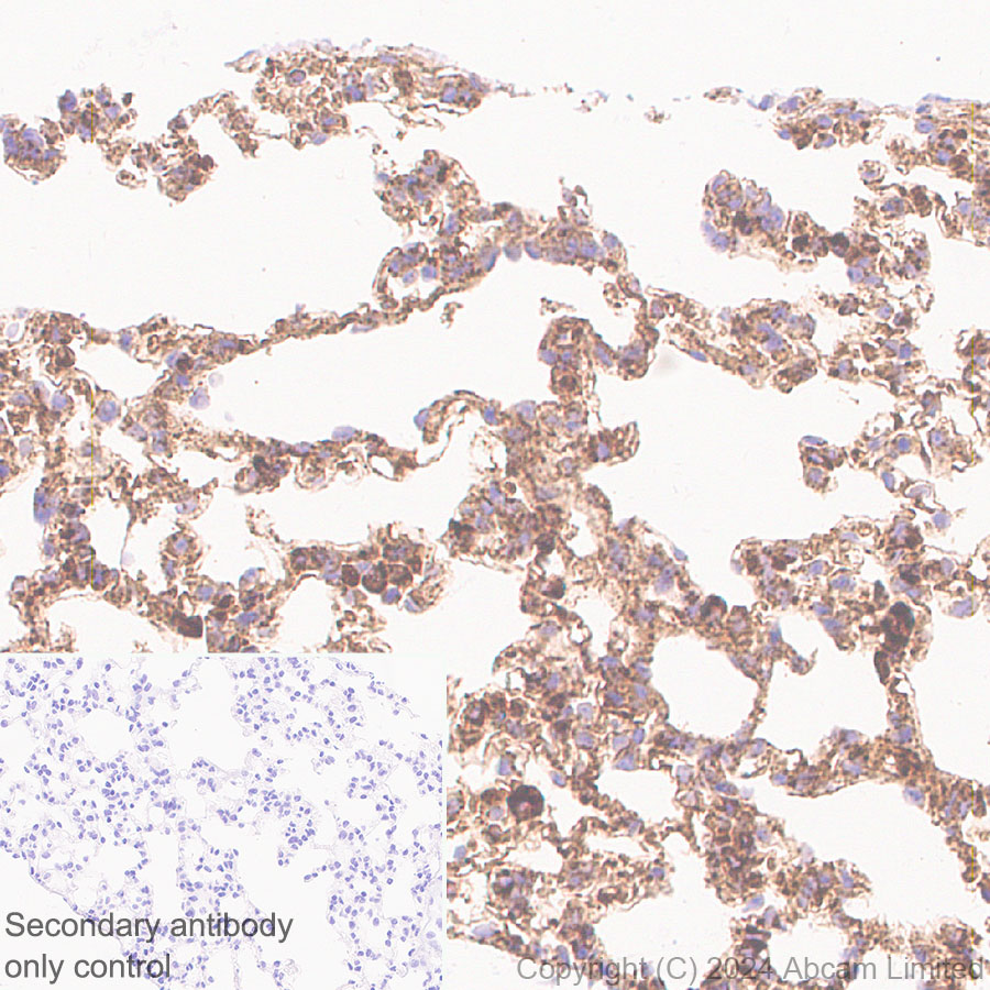 Immunohistochemistry (Formalin/PFA-fixed paraffin-embedded sections) - Anti-LAMP1 antibody [RM1217] (ab320851), expandable thumbnail