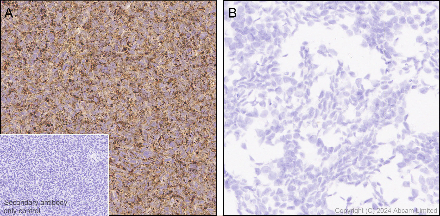 Immunohistochemistry (Formalin/PFA-fixed paraffin-embedded sections) - Anti-LAMP1 antibody [RM1217] (ab320851), expandable thumbnail
