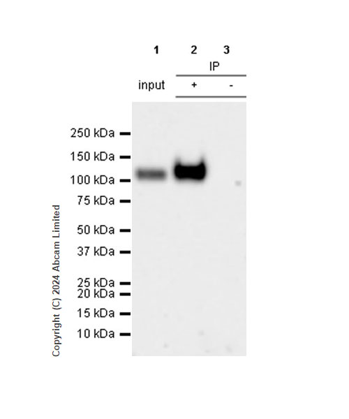 Immunoprecipitation - Anti-LAMP1 antibody [RM1217] - Lysosome Marker (ab320851), expandable thumbnail