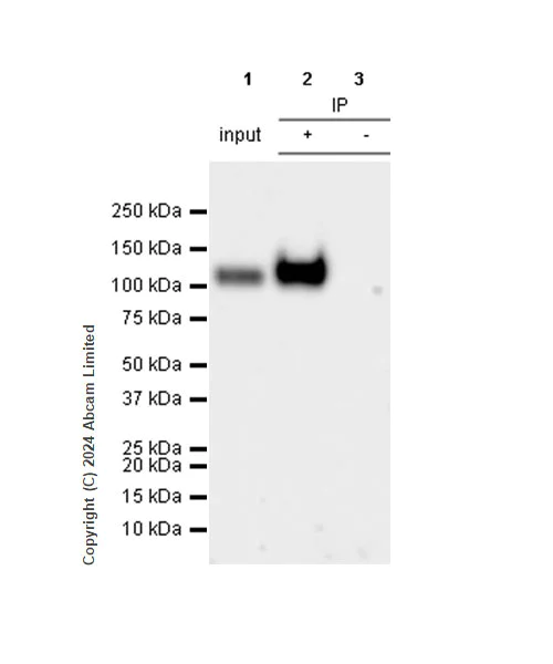 Immunoprecipitation - Anti-LAMP1 antibody [RM1217] - Lysosome Marker (AB320851)