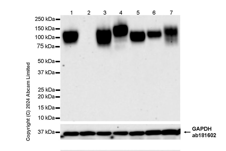 Western blot - Anti-LAMP1 antibody [RM1217] - Lysosome Marker (AB320851), expandable thumbnail