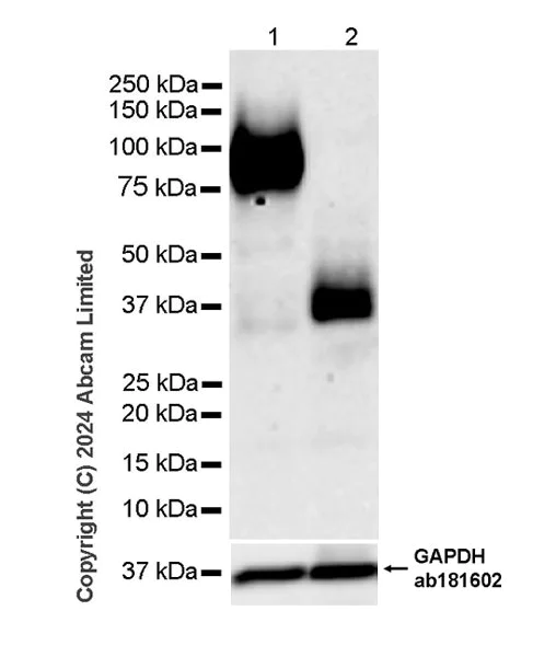 Western blot - Anti-LAMP1 antibody [RM1217] - Lysosome Marker (AB320851)