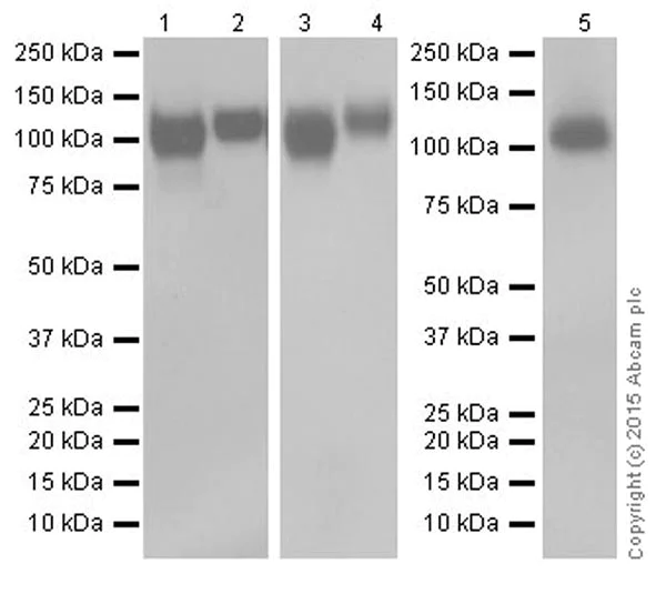 Western blot - Anti-LAMP2 antibody [EPR19512] - Lysosome Marker (AB199946)