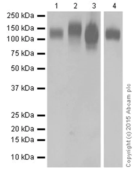 Western blot - Anti-LAMP2 antibody [EPR19512] - Lysosome Marker (AB199946)