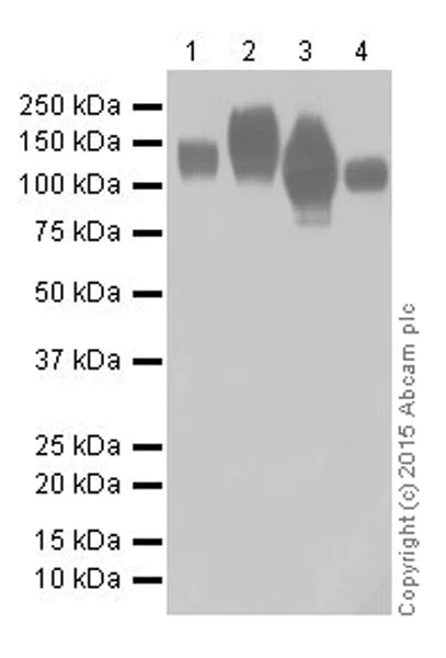 Western blot - Anti-LAMP2 antibody [EPR19531] - Lysosome Marker (AB199947)