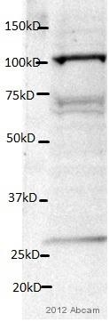 Western blot - Anti-LAMP2 antibody [GL2A7] - Lysosome Marker (AB13524), expandable thumbnail