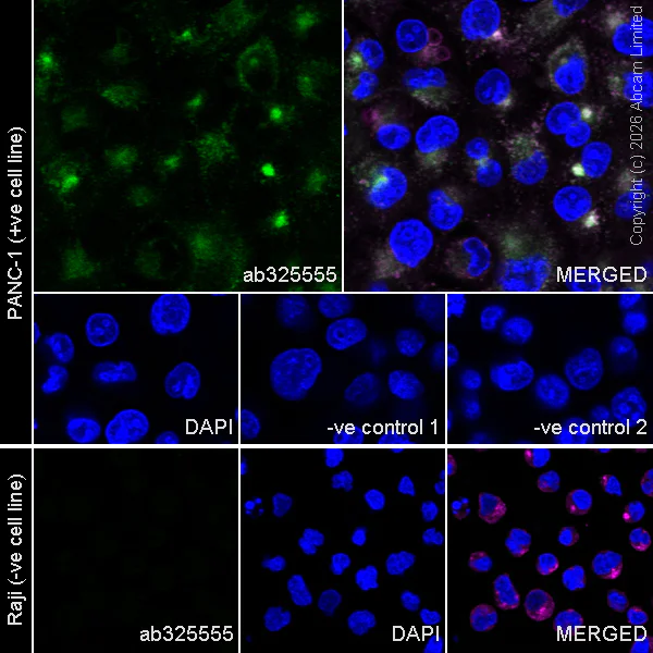 Immunocytochemistry/ Immunofluorescence - Anti-LAMP2 antibody [H4B4] - Lysosome Marker (AB25631)