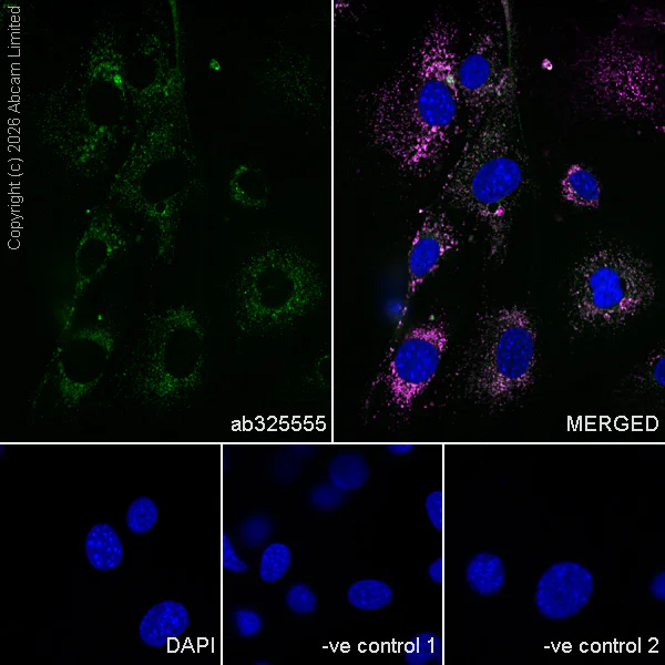 Immunocytochemistry/ Immunofluorescence - Anti-LAMP2 antibody [H4B4] - Lysosome Marker (AB25631)