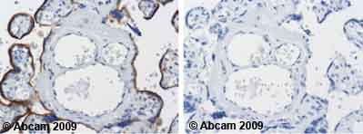 Immunohistochemistry (Formalin/PFA-fixed paraffin-embedded sections) - Anti-LAMP2 antibody [H4B4] - Lysosome Marker (AB25631), expandable thumbnail