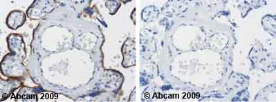 Immunohistochemistry (Formalin/PFA-fixed paraffin-embedded sections) - Anti-LAMP2 antibody [H4B4] - Lysosome Marker (AB25631)